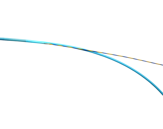Short-wire Delivery System for Biliary Stents